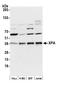 XPA, DNA Damage Recognition And Repair Factor antibody, A301-780A, Bethyl Labs, Western Blot image 