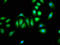 Patatin Like Phospholipase Domain Containing 8 antibody, LS-C673020, Lifespan Biosciences, Immunofluorescence image 