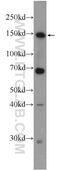 Zinc Finger And BTB Domain Containing 11 antibody, 25215-1-AP, Proteintech Group, Western Blot image 
