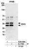 CDV3 Homolog antibody, A304-659A, Bethyl Labs, Immunoprecipitation image 