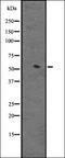 Cytochrome P450 Family 3 Subfamily A Member 4 antibody, orb335428, Biorbyt, Western Blot image 