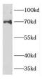 Decapping MRNA 1A antibody, FNab02269, FineTest, Western Blot image 