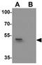 DAP3 Binding Cell Death Enhancer 1 antibody, GTX32077, GeneTex, Western Blot image 