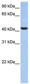 UDP-GlcNAc:BetaGal Beta-1,3-N-Acetylglucosaminyltransferase 7 antibody, TA329585, Origene, Western Blot image 