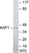Protein Kinase CAMP-Dependent Type I Regulatory Subunit Beta antibody, EKC1707, Boster Biological Technology, Western Blot image 