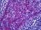 FRAS1 Related Extracellular Matrix 1 antibody, orb94722, Biorbyt, Immunohistochemistry paraffin image 