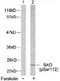BCL2 Associated Agonist Of Cell Death antibody, TA309965, Origene, Western Blot image 
