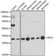 Myeloid Leukemia Factor 2 antibody, A12895, Boster Biological Technology, Western Blot image 