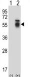 Activin A Receptor Type 1 antibody, abx027646, Abbexa, Western Blot image 