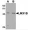 LIM Homeobox Transcription Factor 1 Beta antibody, MBS153689, MyBioSource, Western Blot image 