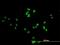 DEAD-Box Helicase 47 antibody, H00051202-B01P, Novus Biologicals, Immunofluorescence image 