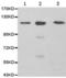 Probable ATP-dependent RNA helicase DDX58 antibody, TA322385, Origene, Western Blot image 