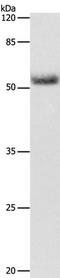Cytochrome P450 Family 19 Subfamily A Member 1 antibody, TA321053, Origene, Western Blot image 