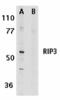 Receptor Interacting Serine/Threonine Kinase 3 antibody, AHP1797, Bio-Rad (formerly AbD Serotec) , Immunohistochemistry paraffin image 