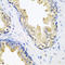 Serine Peptidase Inhibitor, Kunitz Type 2 antibody, LS-C334920, Lifespan Biosciences, Immunohistochemistry frozen image 
