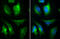 Inositol Polyphosphate-5-Phosphatase F antibody, GTX104273, GeneTex, Immunocytochemistry image 