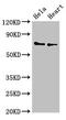Plastin 3 antibody, CSB-PA018206LA01HU, Cusabio, Western Blot image 
