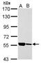 IlvB Acetolactate Synthase Like antibody, GTX120588, GeneTex, Western Blot image 