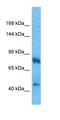 3-Hydroxy-3-Methylglutaryl-CoA Reductase antibody, orb325142, Biorbyt, Western Blot image 
