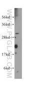 RPA-interacting protein antibody, 15220-1-AP, Proteintech Group, Western Blot image 