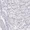 Mast cell antigen 32 antibody, HPA014347, Atlas Antibodies, Immunohistochemistry frozen image 
