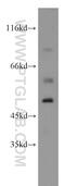 Sarcoglycan Epsilon antibody, 12407-1-AP, Proteintech Group, Western Blot image 