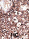 LDL Receptor Related Protein 8 antibody, 62-148, ProSci, Immunohistochemistry paraffin image 