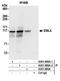 Echinoderm microtubule-associated protein-like 4 antibody, A301-908A, Bethyl Labs, Immunoprecipitation image 