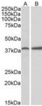 Caveolae Associated Protein 3 antibody, NBP1-45210, Novus Biologicals, Western Blot image 