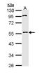 Membrane Palmitoylated Protein 1 antibody, LS-C186228, Lifespan Biosciences, Western Blot image 