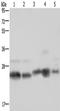 NADH:Ubiquinone Oxidoreductase Core Subunit V2 antibody, TA350222, Origene, Western Blot image 
