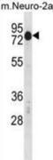 Cysteine And Serine Rich Nuclear Protein 2 antibody, abx030437, Abbexa, Western Blot image 
