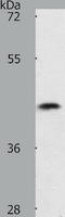 Plasminogen Activator, Tissue Type antibody, TA321237, Origene, Western Blot image 