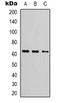 Far Upstream Element Binding Protein 3 antibody, orb318814, Biorbyt, Western Blot image 