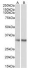 Monoglyceride Lipase antibody, orb19939, Biorbyt, Western Blot image 