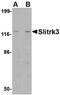 SLIT And NTRK Like Family Member 3 antibody, orb74937, Biorbyt, Western Blot image 