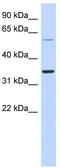 Retroviral-like aspartic protease 1 antibody, TA337869, Origene, Western Blot image 