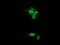 SPG7 Matrix AAA Peptidase Subunit, Paraplegin antibody, MA5-25909, Invitrogen Antibodies, Immunocytochemistry image 