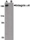 CD49D antibody, PA5-20595, Invitrogen Antibodies, Western Blot image 