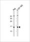 5', 3'-Nucleotidase, Cytosolic antibody, 61-294, ProSci, Western Blot image 