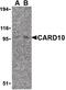 Caspase Recruitment Domain Family Member 10 antibody, PA5-19997, Invitrogen Antibodies, Western Blot image 
