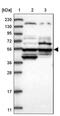 POC5 Centriolar Protein antibody, PA5-57981, Invitrogen Antibodies, Western Blot image 