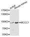 Methylcrotonoyl-CoA Carboxylase 1 antibody, STJ112060, St John
