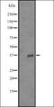 Olfactory Receptor Family 52 Subfamily Z Member 1 (Gene/Pseudogene) antibody, orb335526, Biorbyt, Western Blot image 