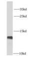 LSM2 Homolog, U6 Small Nuclear RNA And MRNA Degradation Associated antibody, FNab04874, FineTest, Western Blot image 