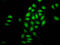 Nucleoporin 98 antibody, CSB-PA016209LA01HU, Cusabio, Immunofluorescence image 