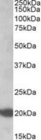 Ras antibody, ab77392, Abcam, Western Blot image 