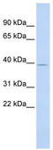 Sterile Alpha Motif Domain Containing 8 antibody, TA344299, Origene, Western Blot image 