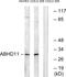 Abhydrolase Domain Containing 11 antibody, GTX87129, GeneTex, Western Blot image 