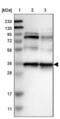 Nucleoporin 35 antibody, NBP1-92214, Novus Biologicals, Western Blot image 